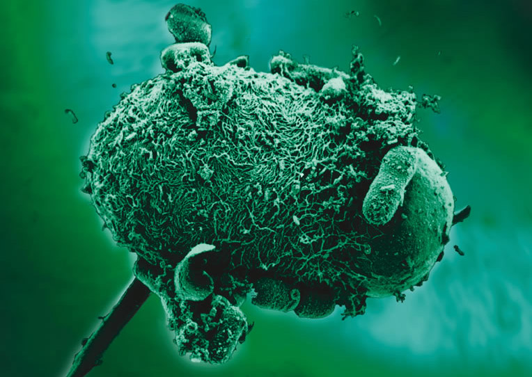 argo gyógyszer férgek ellen a pinworms meghalnak e a hidegtől